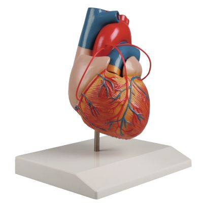 Herzmodell mit Bypass | Praxis-Partner.de